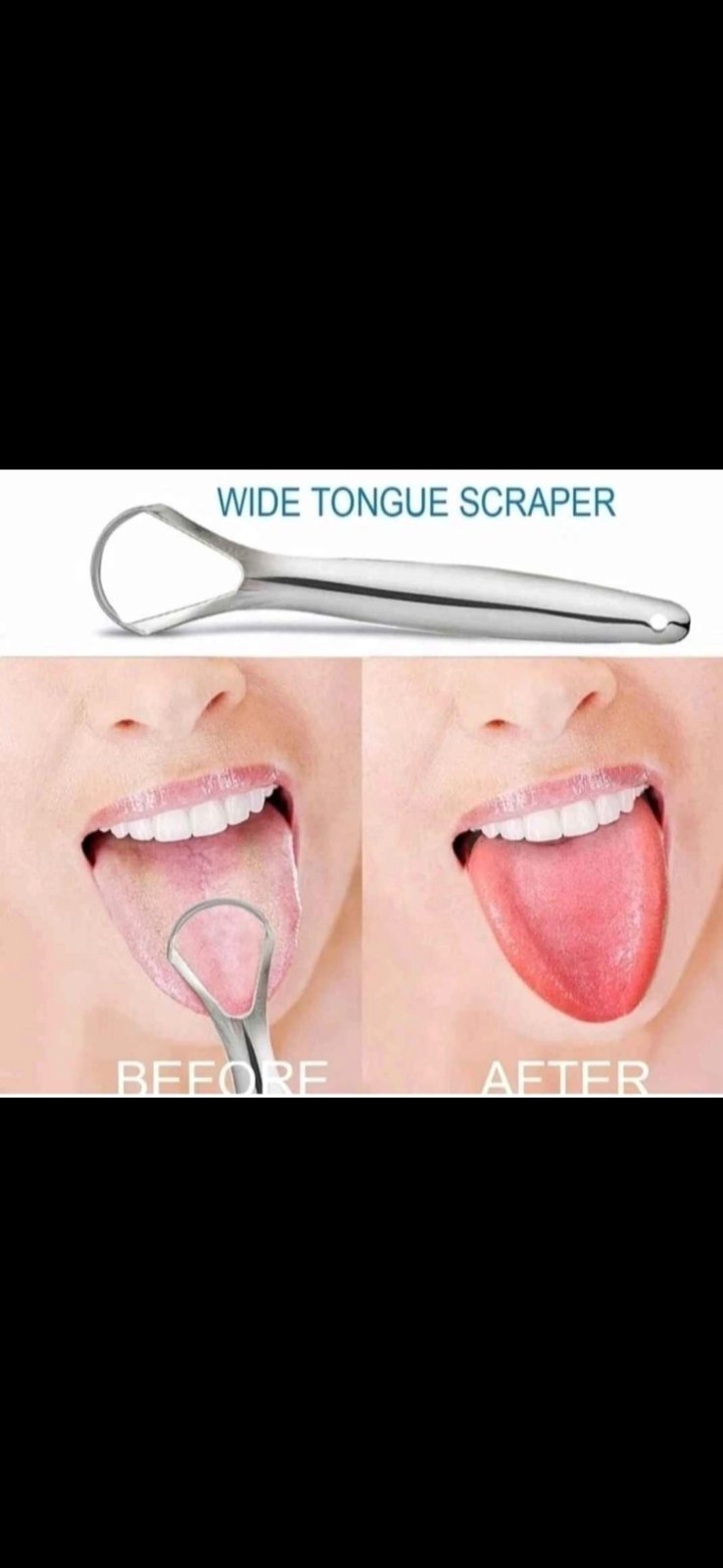 2000x Joblot Of Tongue Scrapers — photo 2
